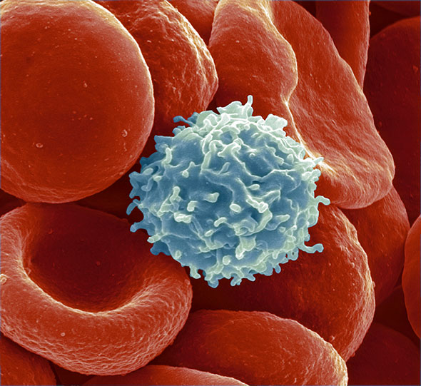 Lymphocyte. Pilier de notre système immunitaire, cette cellule (en bleu, entourée de globules rouges) peut être mobilisée pour lutter contre les tumeurs. © Keystone/Science Photo Library/Steve Gschmeissner
