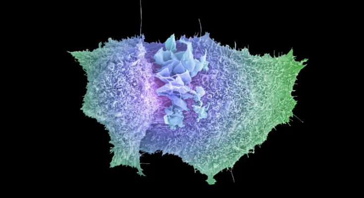 cancer 93 1