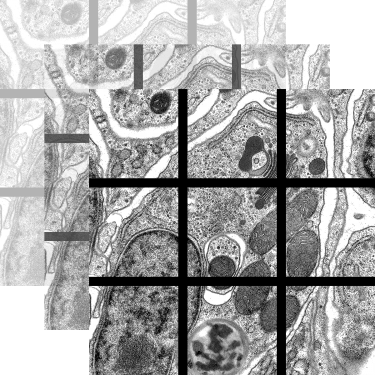 Quelques Images De Microscopie lectronique Au Jardin Botanique De