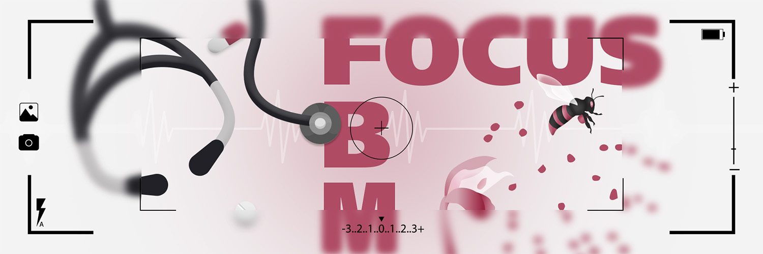 FOCUS FBM