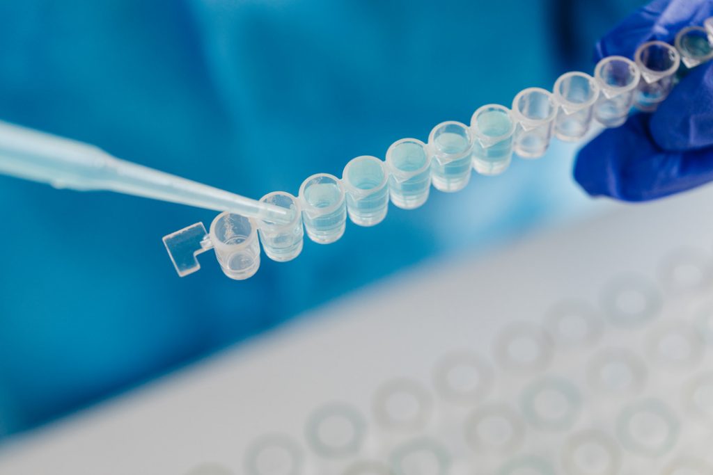 kaboompics pipette filling microtube strip for stem experiment 26302